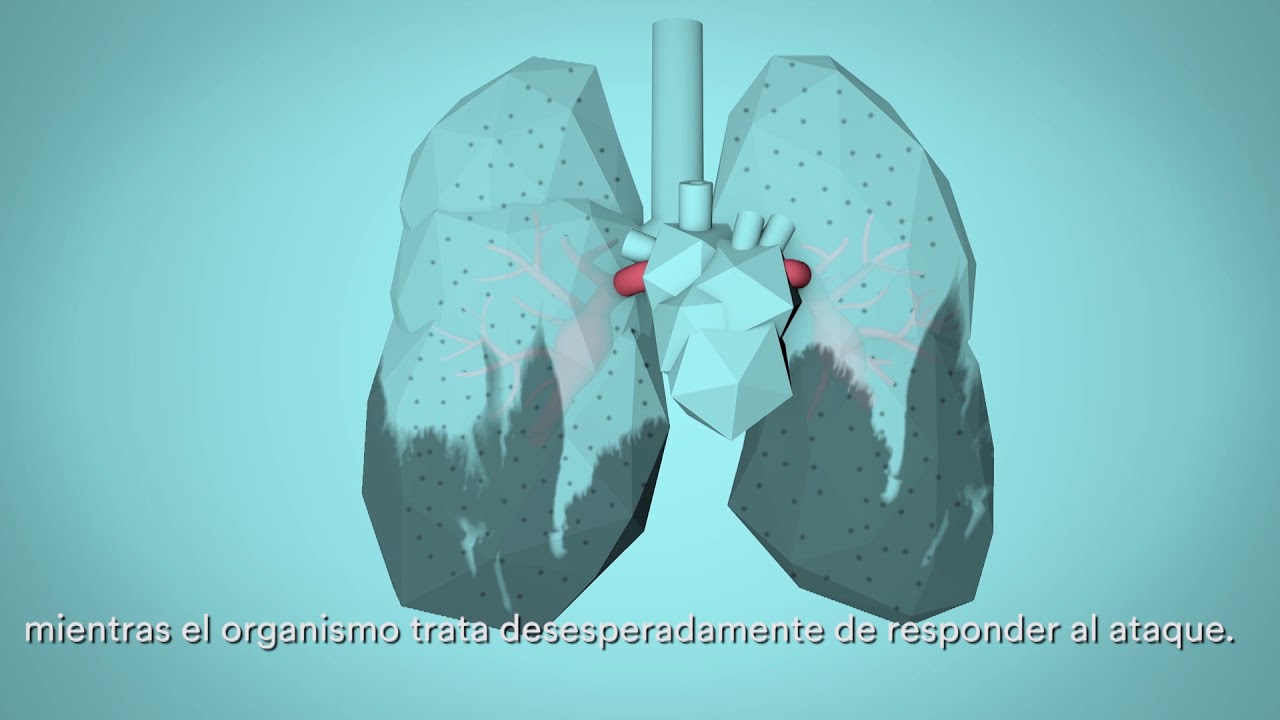 El impacto de la contaminación del aire en la salud respiratoria